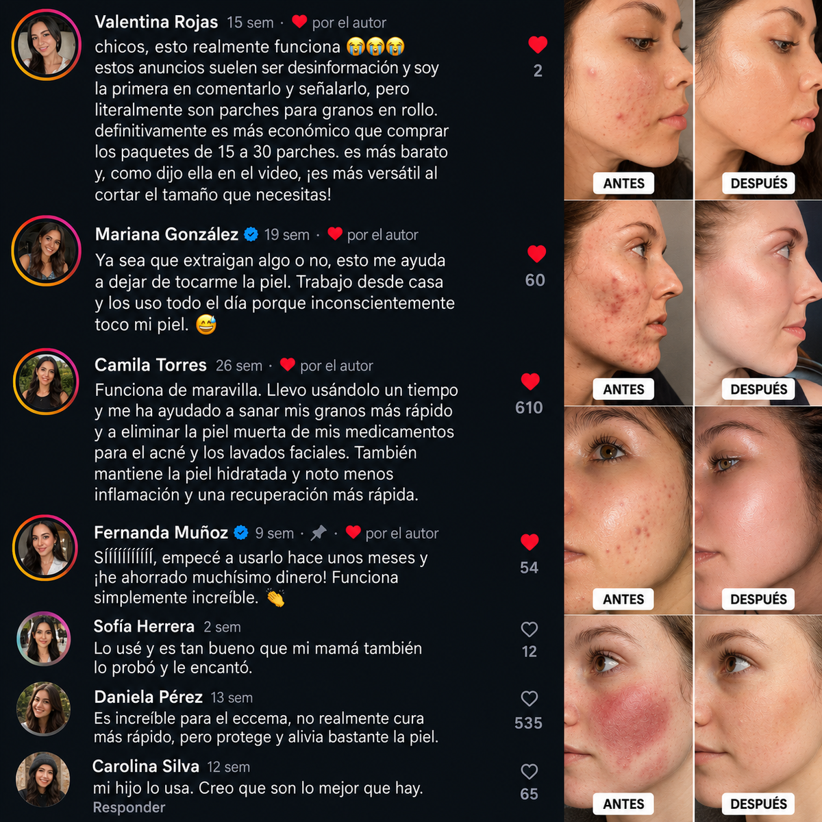 DermaSeal™ - Parche Anti-Granos en Rollo