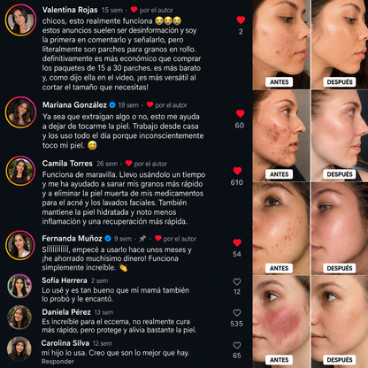DermaSeal™ - Parche Anti-Granos en Rollo